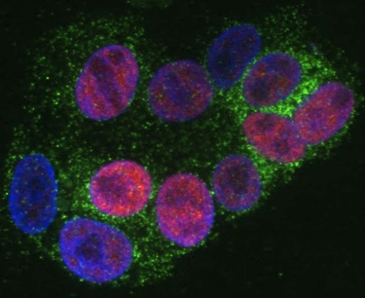 Фибробласты, находящиеся в процессе перепрограммирования в индуцированные плюрипотентные стволовые клетки. Активация гена LIN-41 (показан зеленым) помогла устранить молекулярное препятствие, мешающее эффективному перепрограммированию.