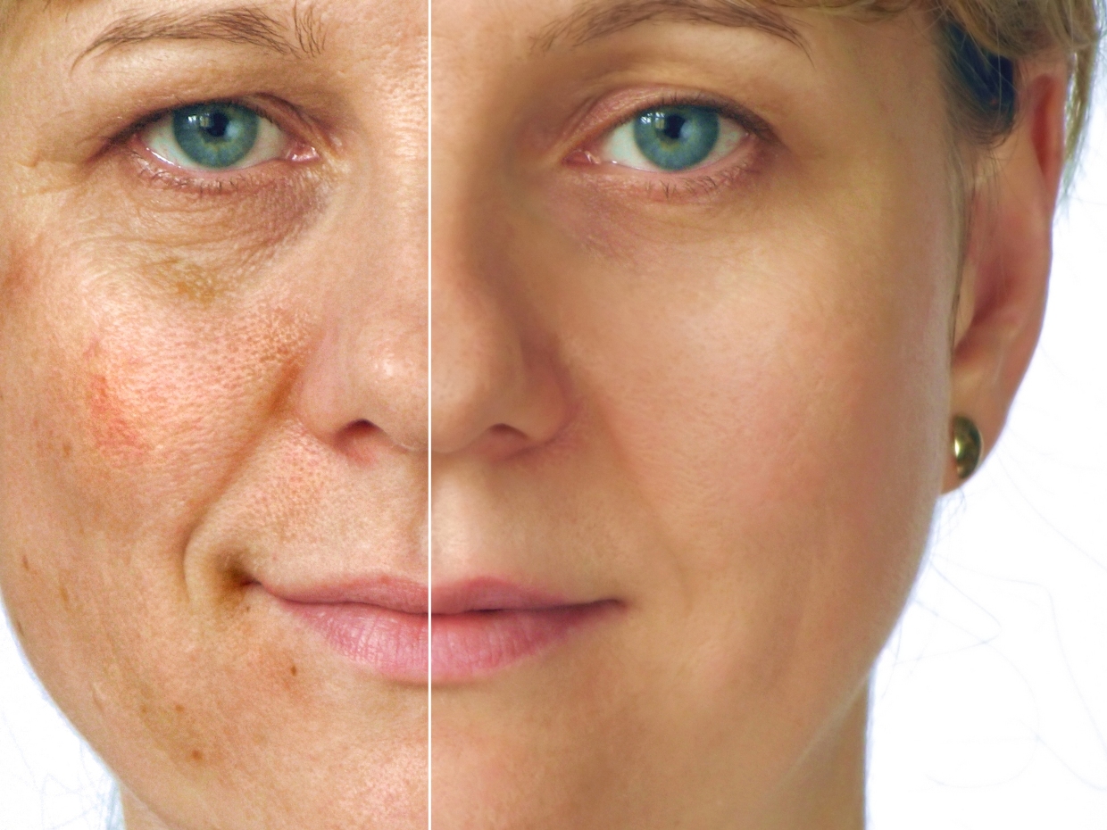 Несмотря на прогресс регенеративной медицины, ученые не могут остановить процесс старения кожи, и с возрастом она необратимо теряет свои свойства.