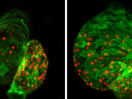 Вышедшее из-под контроля развития сердце: отсутствие транскрипционного фактора Ajuba (на показано на правом фото) нарушает развитие сердца эмбриона рыбы. В дополнение к увеличению числа клеток сердечной мышцы (зеленые с окрашенными красным ядрами), сердце деформировано.
