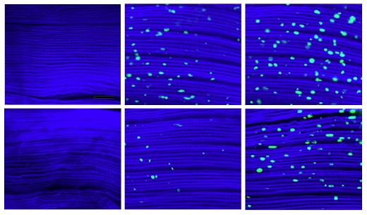 «Грязные» мышцы. За 1, 3 и 5 недель (слева направо) в мышечных волокнах контрольных мух (верхний ряд) накопились большее количество белковых агрегатов (показаны как зеленые пятнышки), чем в волокнах, в которых подавленный белок dawdle не затруднял аутофагию.