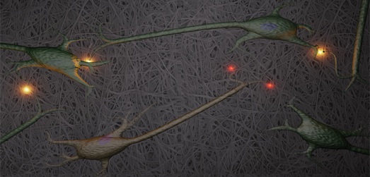 Нейроны, растущие на трехмерной подложке из наноцеллюлозы. Одно из направлений, для изучения которых шведские ученые планируют использовать выращенные на наноцеллюлозе нервные клетки, – разрушение синапсов, являющееся одним из ранних признаков болезни Альцгеймера. На изображении функционирующие синапсы показаны желтым, разрушенные – красным.