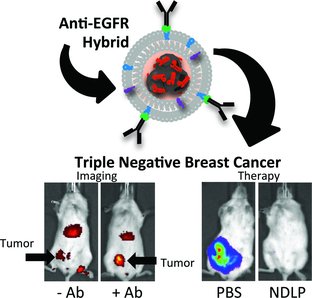Принцип действия самоорганизующихся гибридных липидо-наноалмазных частиц (NDLPs) основан на сильном взаимодействии поверхности наноалмазов (ND) с малыми молекулами. NDLPs делают возможной адресную клеточную визуализацию и лечение тройного негативного рака молочной железы. NDLPs, мишенями которых являются рецепторы эпидермального фактора роста, – высоко биосовместимые частицы, обеспечивающие визуализацию специфических клеток, способствующие удержанию опухолью ND-комплексов, предотвращающие токсические эффекты эпирубицина и опосредующие регрессию опухолей, относящихся к тройному негативному раку молочной железы.
