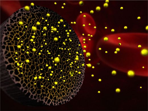 Несущие миРНК нанолипосомы (желтые)  высвобождаются из кремниевых наночастиц (серые) вблизи своих мишеней –  раковых клеток (не показаны на рисунке). Внутривенные инъекции  микроскопических систем доставки лекарств модельным животным привели к  сокращению веса опухолей яичников в пределах 36-83 процентов в  зависимости от дозы.