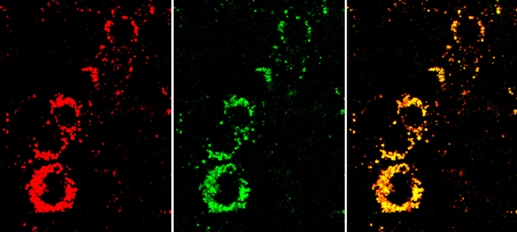 Желтый сигнал наносенсоров на изображении (справа) показывает, что клетки активны. При нарушении состояния клетки выглядели бы более красными. В центре: сигнал чувствительного к АТФ красителя-индикатора; слева: сигнал  референсного красителя.