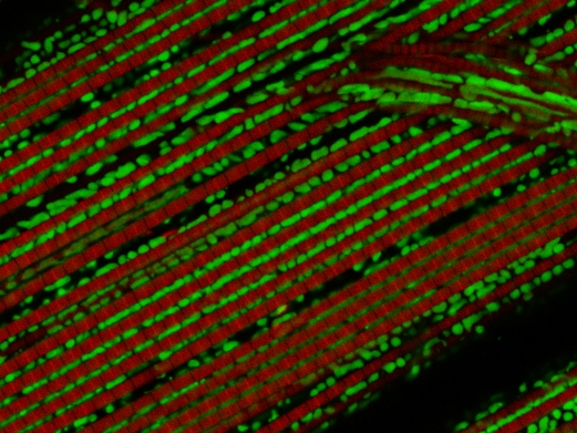 Ген PINK1 играет важную роль в развитии болезни Паркинсона. При подавлении этого гена у дрозофил повреждаются митохондрии (зеленые), после чего происходит распад мышечных волокон (красные). Активация рецепторов Ret, которые у человека связывают нейротрофический фактор GDNF, противодействует дегенерации мышц.