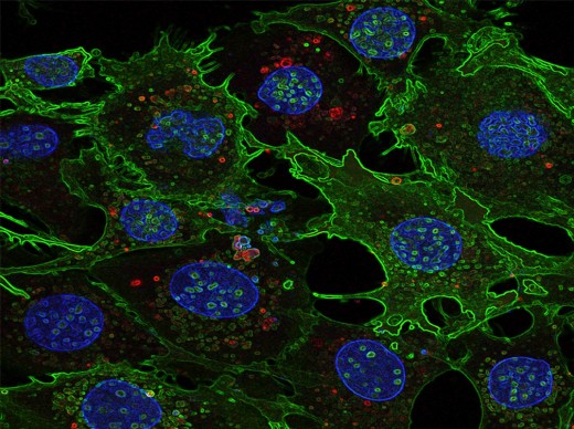 Быстрое (2 часа) in vitro поглощение экстрацеллюлярных везикул клетками-мишенями через плазматическую мембрану.