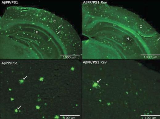 Мыши линии AβPP/PS1 (amyloid-β protein precursor/presenilin 1) демонстрируют усиленные нейропатологические признаки заболевания, близкого к наследственной форме болезни Альцгеймера. Болезнь Альцгеймера – нейродегенеративный процесс, вызывающий тяжелые когнитивные нарушения; для нее характерно накопление бета-амилоидного белка (Аβ) и гиперфосфорилированных форм тау, а также окислительный и воспалительный процессы в головном мозге. Так как эффективной терапии болезни Альцгеймера не существует, ученые прилагают значительные усилия к тому, чтобы понять вовлеченные в ее развитие биохимические пути. Полифенол ресвератрол индуцирует экспрессию и активацию нескольких нейропротекторных путей, включая пути Sirtuin1 и AMPK. Целью данной работы было оценить влияние перорального приема ресвератрола на мышей линии AβPP/PS1 с моделью болезни Альцгеймера. По оценкам, основанным по тестах на распознавание объектов, длительное лечение ресвератролом в значительной степени предотвращало потерю памяти. Кроме того, ресвератрол снизил уровень амилоида и повысил уровни белков митохондриального комплекса IV в мозге мышей. Эти защитные эффекты ресвератрола в основном опосредованы повышенной активацией путей Sirtuin 1 и AMPK. Однако усиление также наблюдалось в экспрессии генов IL1β и TNF, что указывает на то, что ресвератрол способствует изменениям в воспалительных процессах, хотя никаких изменений в других ключевых игроках пути окислительного стресса установлено не было. Взятые вместе, эти результаты показывают, что ресвератрол способен ослабить патологический процесс, протекающий в гиппокампе AβPP/PS1-мышей и предотвратить потерю памяти.
