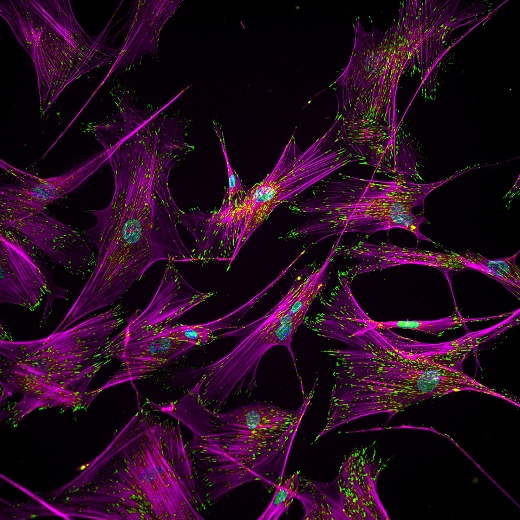 Взрослые человеческие фибробласты с внутриклеточными белками, участвующими в адгезии этих клеток к экстрацеллюлярному матриксу. Пурпурным цветом представлены стрессовые волокна актина, зеленым – белок фокальной адгезии винкулин, которые вместе определяют, насколько сильно клетки сцепляются с поверхностью матрикса. Синим окрашены ядра клеток. Эти фибробласты могут быть перепрограммированы в человеческие индуцированные плюрипотентные стволовые клетки, в процессе чего происходит реструктуризация белков адгезии.