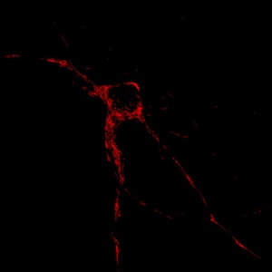Вновь описанные белки помогают регулировать локализацию митохондрий (показаны красным) в нейронах.