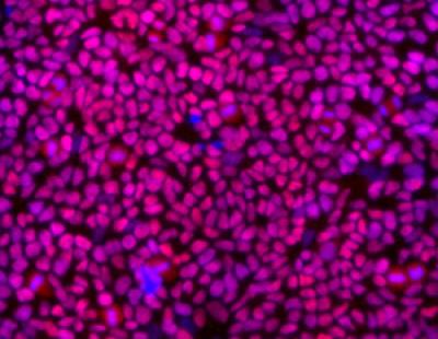 Самообновляющиеся первичные нейральные стволовые клетки, полученные из человеческих эмбриональных стволовых клеток с помощью молекулярных ингибиторов.