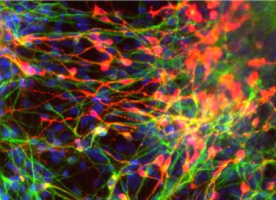 Окрашенные зрелые нейроны, полученные из клеток-предшественников (нейральных стволовых клеток), экспрессирующие нейромедиатор дофамин.