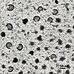 Экзосомы, показанные на этой электронной микрофотографии, - мельчайшие капсулы, вырабатываемые большинством клеток организма.
