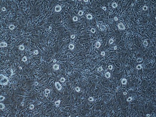 Эмбриональные стволовые клетки, полученные из бластоцисты, развившейся из двухклеточного интерфазного эмбриона, созданного методом переноса ядер соматических клеток (увеличение 40х).