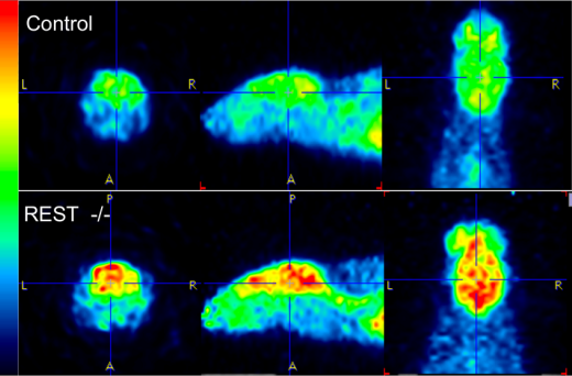 Мыши, у которых отсутствовал белок REST (внизу), демонстрировали гораздо более высокую нервную активность в мозге (показано красным), чем нормальные мыши (вверху).