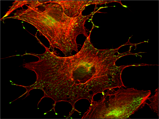 Меланоциты – клетки, синтезирующие пигмент меланин, ответственные за цвет кожи. С помощью трех транскрипционных факторов (SOX10, MITF и PAX3) ученые напрямую перепрограммировали в меланоциты кожные фибробласты.