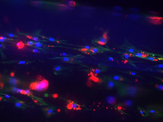 Покрытые клетками: клетки растут вдоль полимерных нитей, показанных зеленым.