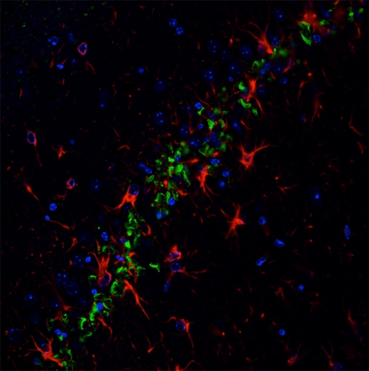 Пироглютамилированный бета-амилоид (зеленый) накапливается в мозге генно-инженерных мышей с его повышенной экспрессией. Красные клетки – астроциты, заселяющие области накопления амилоида и гибели нейронов. Синие структуры – ядра нейронов и астроцитов.