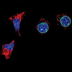 Ученые установили, что белок нуклеопорин Nup153 (зеленый) управляет развитием эмбриональных стволовых клеток (синие). Удаление Nup153 вызывает их быструю дифференцировку в предшественники нейронов (красные).