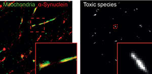 Альфа-синуклеин в митохондриях нейрона (слева) и отдельные агрегаты альфа-синуклеина