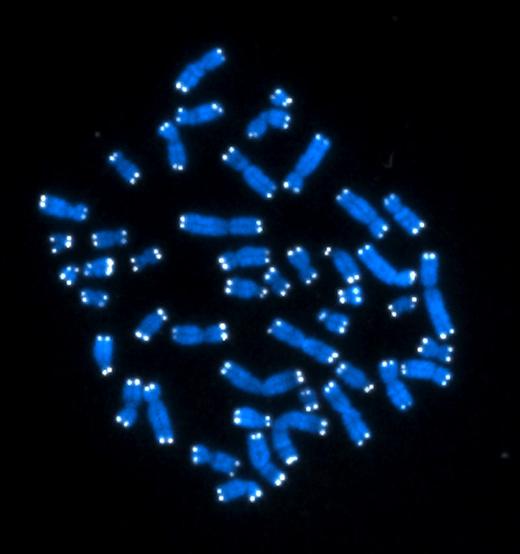 46 хромосом человека (показаны синим) с теломерами на концах (белые точки). Процесс репликации ДНК уже закончен, и каждая хромосома представлена двумя идентичными копиями, каждая из которых обладает двумя собственными теломерами.