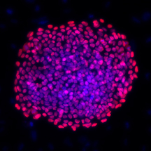 Адъюнкт-профессор Шэн Дин и его коллеги сообщают о разработке нового коктейля из низкомолекулярных соединений, который, вместе с геном Oct4, позволяет перепрограммировать человеческие клетки кожи в стволовые клетки. На снимке: перепрограммированные клетки экспрессируют типичные маркеры плюрипотентности, в том числе, OCT4.