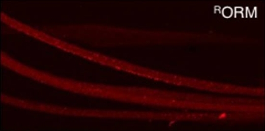 Ярко-красные пятна – кластеры наночастиц  ORMOSIL в аксонах нейронов плодовой мушки. (Конфокальная микроскопия).