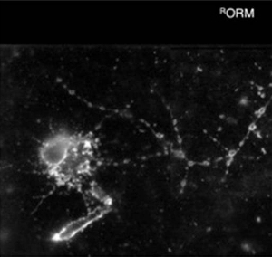Нейрон в первичной нейрональной культуре, полученной из мозга плодовой мушки, ярко светится благодаря ORMOSIL - наночастицам, имеющим хорошие перспективы в качестве средства доставки лекарств в мозг.