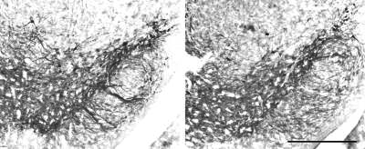 Чой и др. показали, что ротенон – препарат, индуцирующий болезнь Паркинсона у грызунов – селективно убивает дофаминэргические нейроны, вызывая деполимеризацию микротрубочек, что приводит к накоплению дофамина и активных форм кислорода. Считалось, что ротенон и другие факторы вызывают болезнь Паркинсона, ингибируя митохондриальный комплекс I, но Чой и др. продемонстрировали, что ни генетического, ни химического ингибирования комплекса I недостаточно, чтобы привести к смерти дофаминэргических клеток. Черная субстанция мышей с отсутствующей субъединицей  Ndufs4 комплекса I (справа) содержит такое же количество тирозингидроксилаза-положительных дофаминэргических нейронов, как и черная субстанция мышей дикого типа (слева).