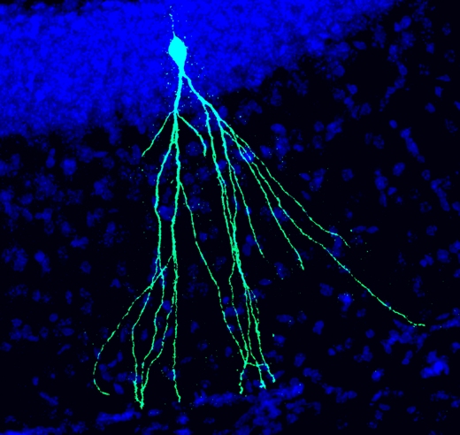 Недавно образовавшийся нейрон в мозге взрослой мыши.