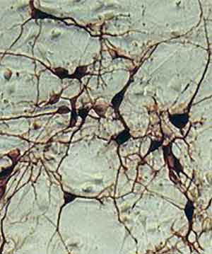 Дофаминергические нейроны in vitro