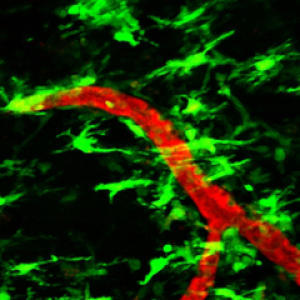 В мышиной модели рассеянного склероза клетки микроглии (зеленые) группируются вокруг высокопроницаемых кровеносных сосудов задолго до неврологических проявлений заболевания.