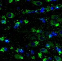 Ферменты ATase1 and ATase2 широко распространены в мозге пациентов с болезнью Альцгеймера. Зеленым цветом помечены ферменты ATases, синим – ядра клеток. Показаны как нейроны, так и клетки глии.