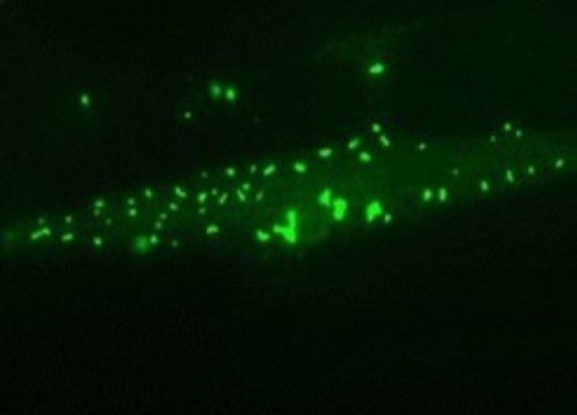 Мышечная клетка долгоживущего червя-нематоды: богатые шаперонами белковые агрегаты (зеленые) накапливаются и защищают клетку в процессе старения.