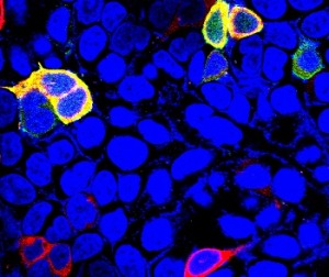 Белок Сестрин 3, флуоресцирующий красным и показанный реагирующим с другими белками печени (желтые), может сыграть значительную роль в лечении диабета 2 типа.