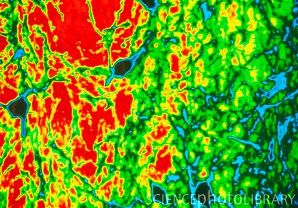 Световая микрофотография дофамин-продуцирующих нейронов (красные) в ткани головного мозга, разрушающихся при болезни Паркинсона. Показана черная субстанция области базальных ганглиев головного мозга. Эта область контролирует моторные функции.