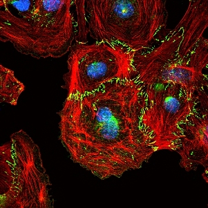 Контакты, образующиеся между эндотелиальными клетками. Трансмембранный белок VE-кадгерин (зеленый) опосредует формирование клеточных контактов и связан с внутриклеточным актином цитоскелета (красный). Ядро окрашено  в синий цвет.