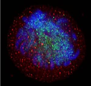 Сиртуин SIRT1 (показан красным) «охраняет» хромосомы (показаны синим). При накоплении повреждений ДНК белки SIRT1 становятся «аварийной бригадой» и оставляют свой хромосомный «сторожевой пост». Постепенно экспрессия генов все больше нарушается, усугубляя процесс старения.