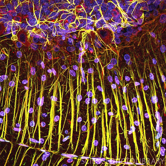 Срез ткани мозжечка. Клетки Пуркинье – тип нейронов – красные, клетки радиальной глии – желтые, клеточные ядра – фиолетовые. Грушевидные клетки Пуркинье имеют множество ветвящихся отростков (дендритов), получающих импульсы от других клеток и направляющихся к поверхности мозжечка. Клетки радиальной глии играют важнейшую роль в нейрональной миграции, построении слоев коры и мозжечка, а также являются клетками-предшественниками в процессе нейрогенеза. Радиальная глия образуется на ранней стадии развития нервной системы из нейроэпителиальных клеток. (Конфокальная световая микроскопия).