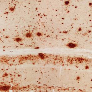 Сенильные бляшки в мозге мыши с моделью болезни Альцгеймера