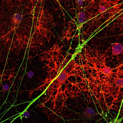 Новое исследование показало, что препарат бензтропин восстанавливает поврежденные рассеянным склерозом нервные волокна в животной модели этого заболевания, стимулируя дифференциацию стволовых клеток – клеток-предшественников олигодендроцитов – в зрелые олигодендроциты.