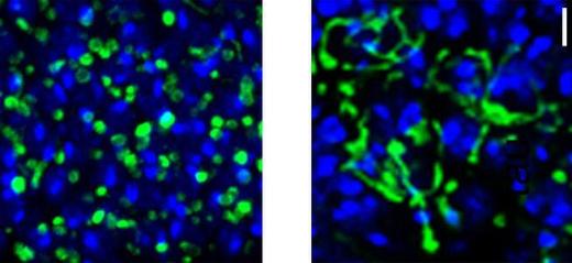 Митохондрии (зеленые) и ядра (синие) клеток дрозофил. На снимке слева показаны нормальные клетки, на снимке справа – клетки с удлиненными митохондриями в присутствии тау-белка.
