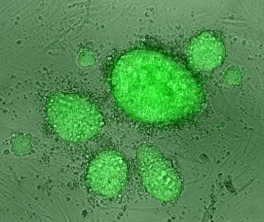 Колония индуцированных плюрипотентных стволовых клеток, полученных с помощью новой методики из одной зрелой иммунной клетки.
