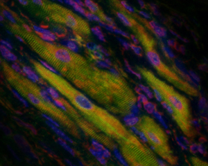 Прямое перепрограммирование способно произвести революцию в регенеративной медицине, так как позволяет превращать один тип взрослых клеток в другой без предварительного возвращения к стадии плюрипотентности. Используя генную инженерию, ученые превратили клетки рубцовой ткани сердца в сокращающиеся клетки сердечной мышцы.