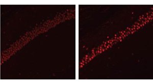 Уровни гистоновой деацетилазы  HDAC2 в гиппокампе  мышей с моделью болезни Альцгеймера выше (справа), чем у здоровых животных.