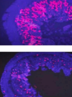 В отличие от клеток ткани кишечника нормальных мышей (вверху) клетки мышей с выключенным  короткими шпилечными РНК геном белкового комплекса PRA3 не пролиферируют, что приводит к атрофии ткани (внизу).
