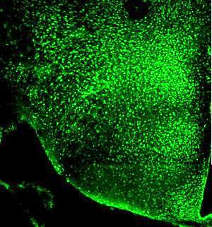 Зеленый краситель подсвечивает белок, связанный со старением, и показывает, что он обильно экспрессируется в гипоталамической области мозга мышей.