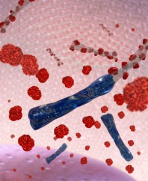 Нити токсичных агрегированных амилоидных пептидов, отличительный признак болезни Альцгеймера, взаимодействуют с белками, такими как антиоксидантный фермент каталаза (показан красным). Взаимодействие инактивирует каталазу, приводя к оксидативному повреждению выращенных в культуре нервных клеток. Устойчивое к воздействию белков покрытие (показано голубым) агрегированных частиц амилоида подавляет взаимодействие и защищает клетки головного мозга от вызванного бета-амилоидом оксидативного стресса и токсического повреждения.