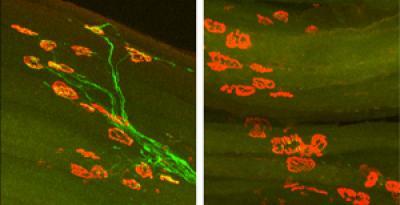 Регенерация аксонов у мыши через две недели после повреждения седалищного нерва задней конечности. Аксоны (зеленые) нормальной мыши восстановились и достигли своих мышечных мишеней (красные) (слева). В отсутствии DLK ни один из аксонов не восстановился.