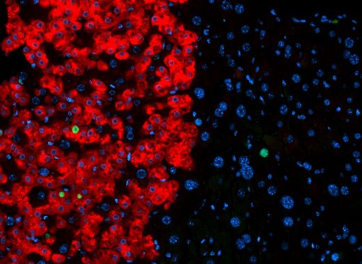 Иммуноокрашивание человеческого альбумина (красный) и Ki67 (зеленый) показывает, что после трансплантации в печень мышей полученные из человеческих клеток кожи гепатоциты функционируют и пролиферируют, как клетки, составляющие естественную ткань печени.
