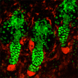 Используя 2-х фотонную прижизненную микроскопию, ученые Йельского университета получили изображения волосяных фолликулов мыши. На снимке ядра эпителиальных клеток окрашены зеленым; мезенхимальные клетки, активные на ранних стадиях развития, – красным. Исследователи установили, что мезенхимальные клетки имеют решающее значение для роста волос.